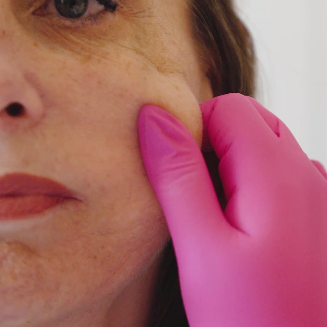 10.(s texto) Antes & Depois - Mãe - frame at 0m22s